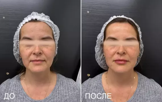 Результат 7